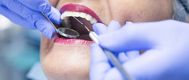 Best Broken or Cracked Tooth Emergency Dentist in Long Beach, CA